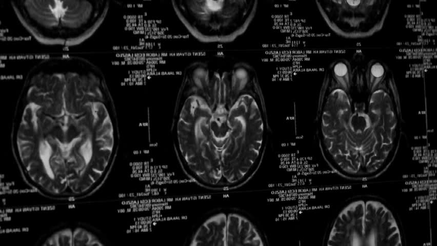 Viewing mri ct scan
