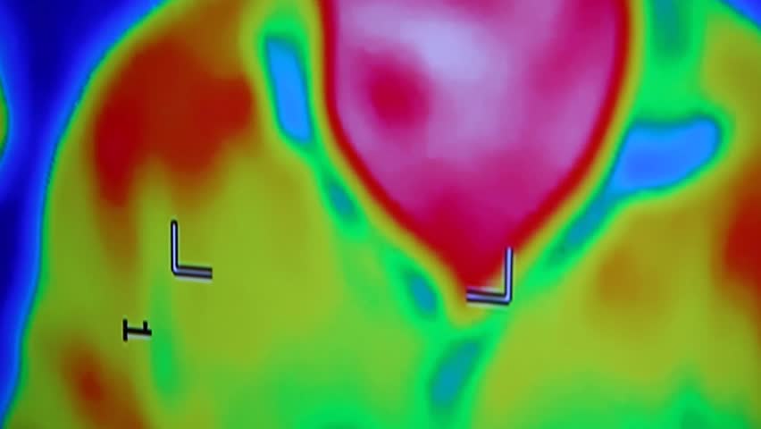 Infrared radiation thermal imaging camera of a man
