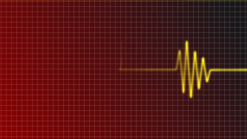 cardiogram curve with music note