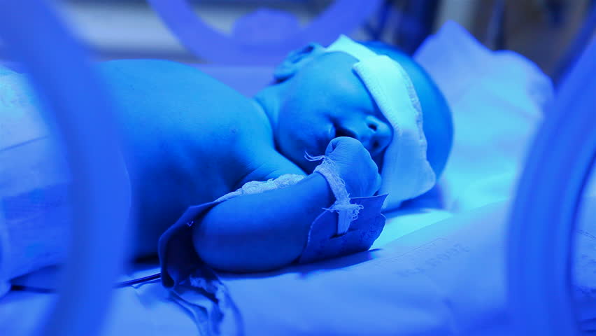 premature baby in an incubator