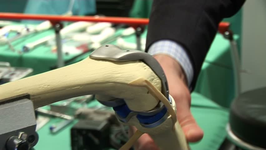 Knee procedure