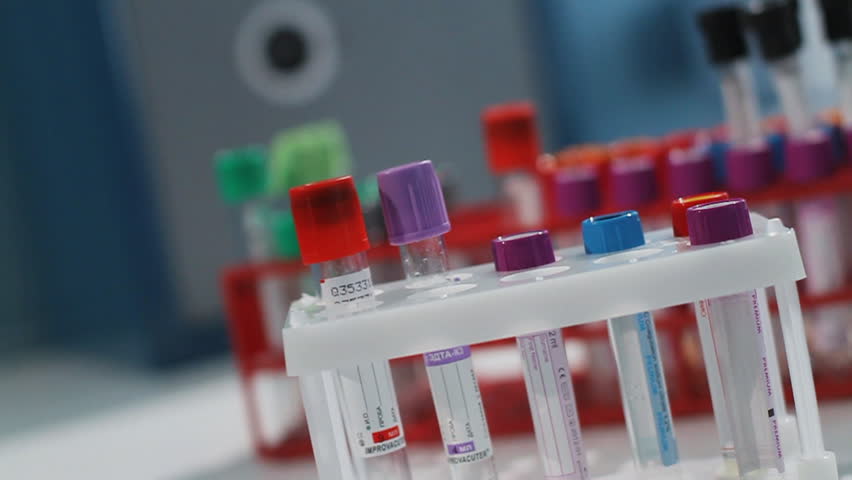 Nurse puts a test tube with the blood analysis in a support under laboratory flasks.