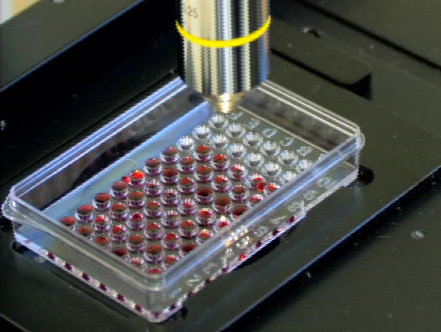 PRAGUE - APRIL 11: Doctor uses microscope to analyze blood sample. April 11th, 2007, Prague, Czech Republic