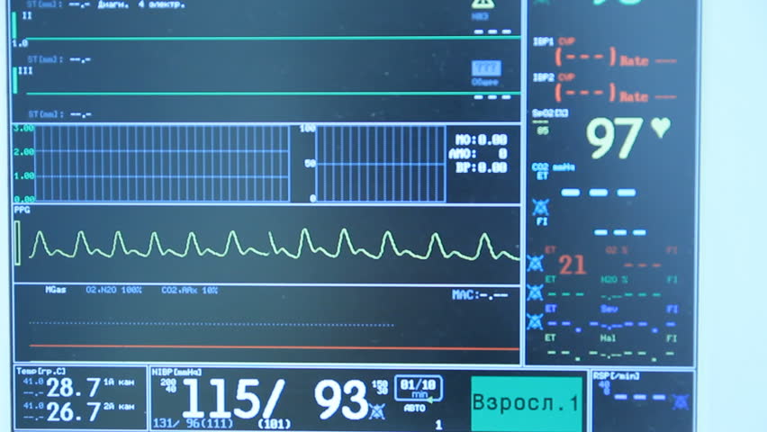 Operating. Hospital. Cardiac
