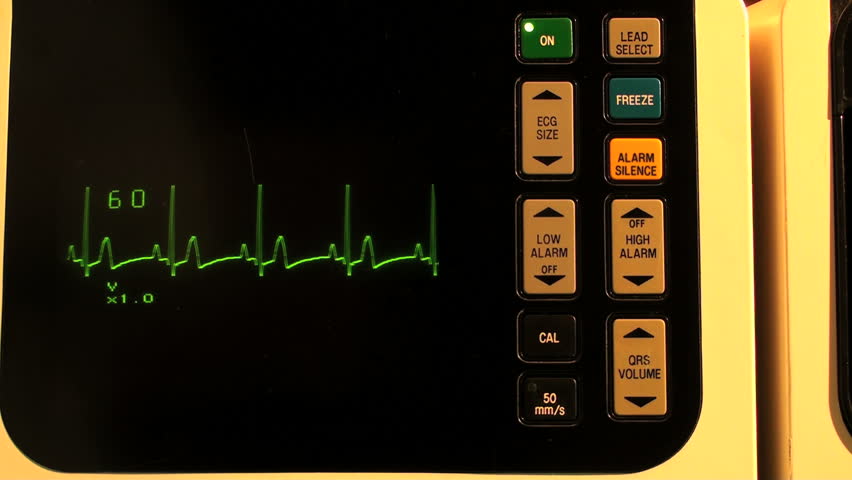 EKG defibrillator full screen SEAMLESS LOOP - with sound, HD 1080