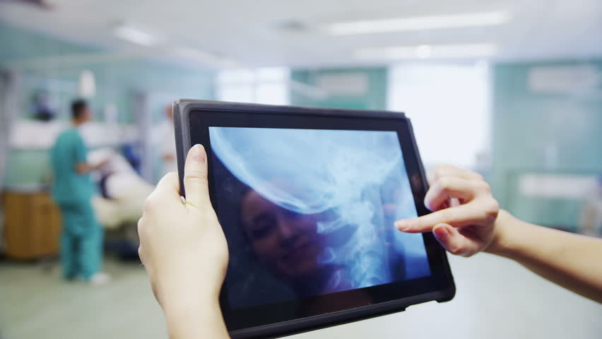 Medical staff are doing their hospital rounds and a young trainee nurse takes a patient's x-ray results to the doctor. In slow motion.