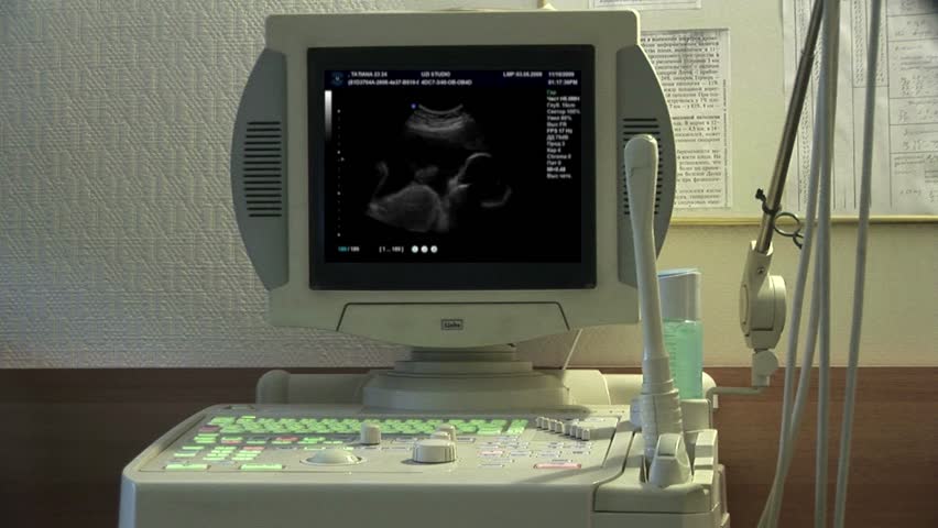 Baby Ultrasound 