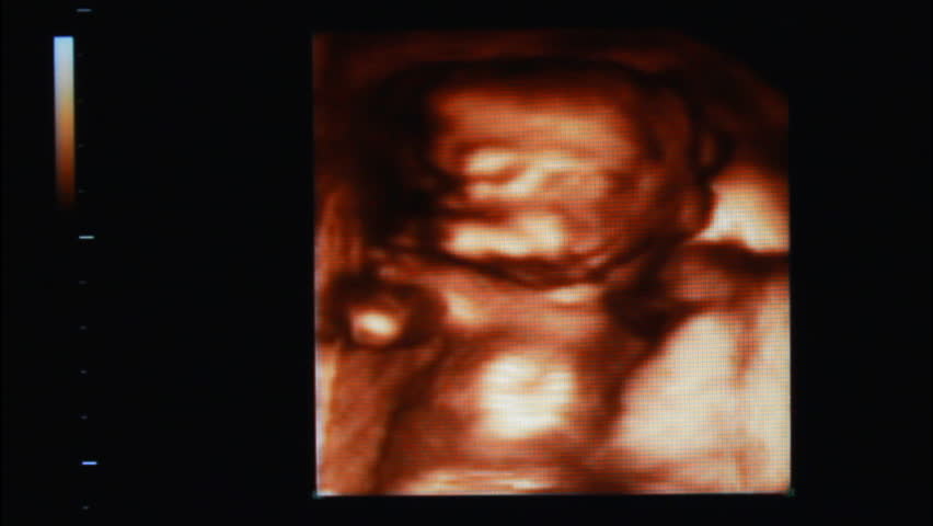 baby ultrasound video