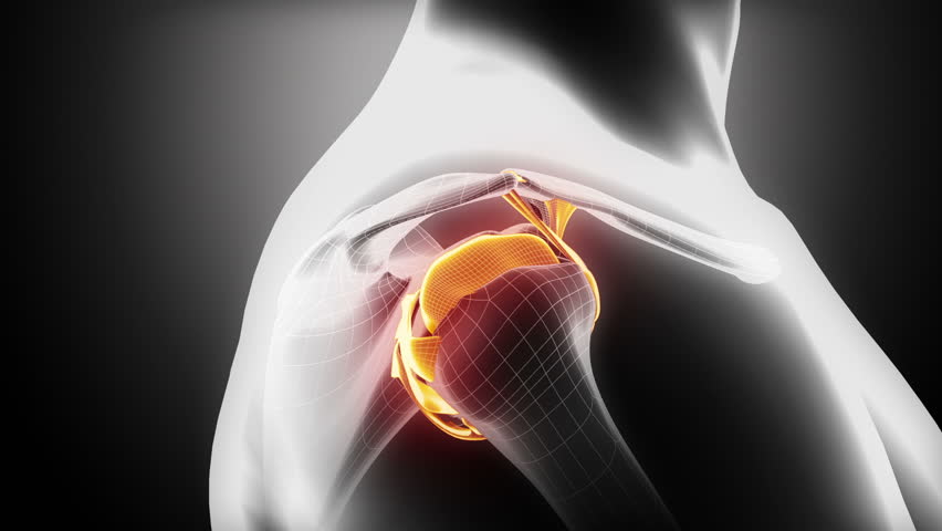 Header of shoulder