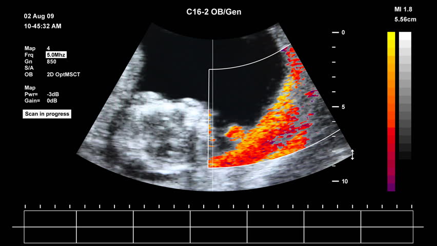 Medical ultrasound scan of human embryo		 