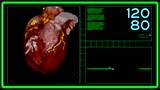A fictional hospital computer screen monitoring a human heart.