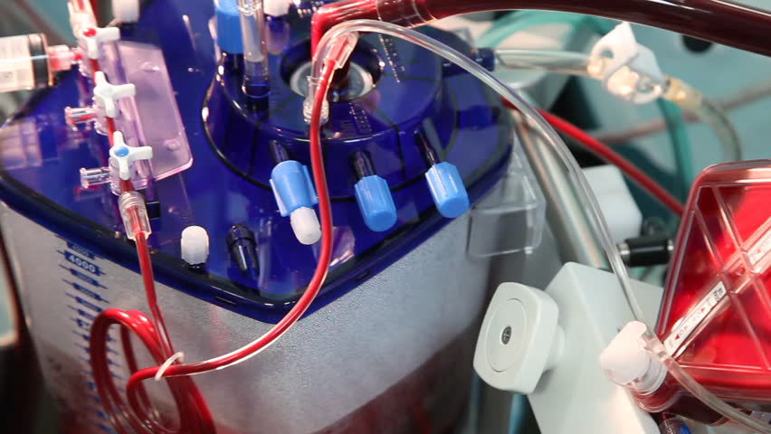 Cardiopulmonary bypass reservoir on cardiac surgery