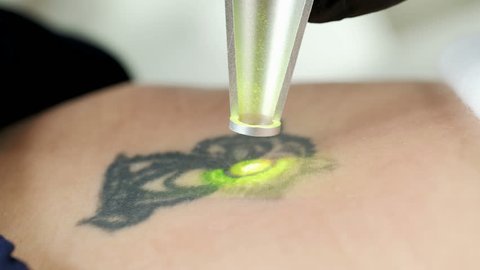 Laser Hair Removal Stock Video Footage 4k And Hd Video Clips