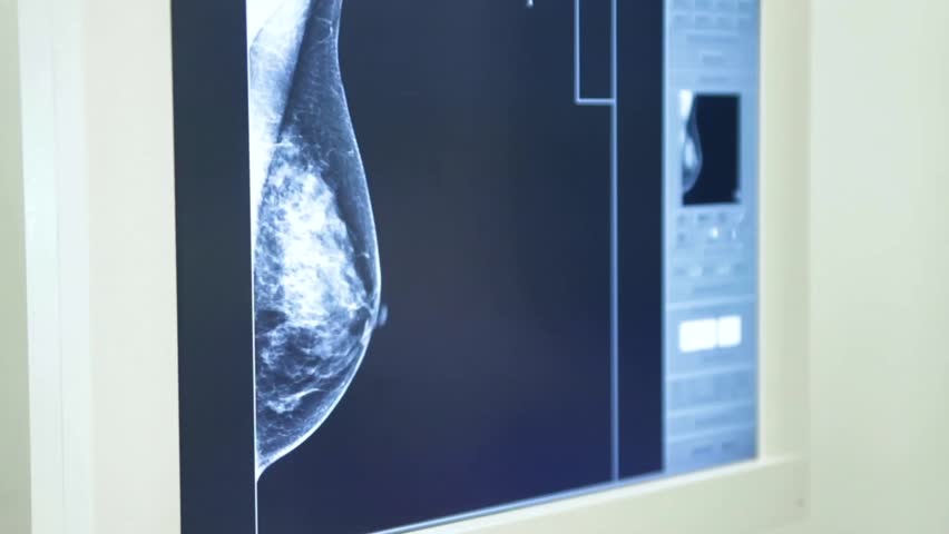 Header of mammography