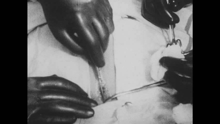Header of omentum