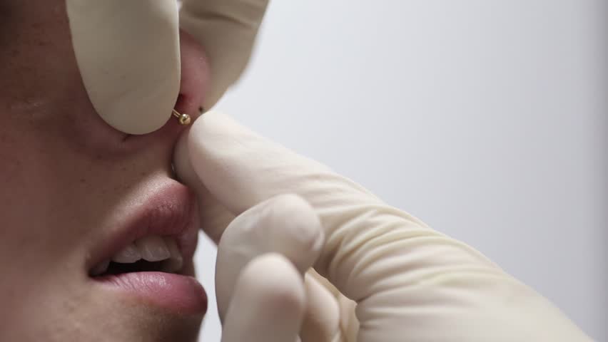 Header of septum