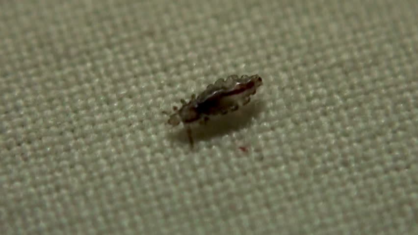 Human Head Lice Macro Shot Stock Footage Video 100 Royalty