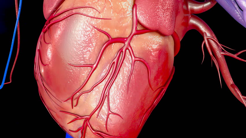 Header of myocardial infarction