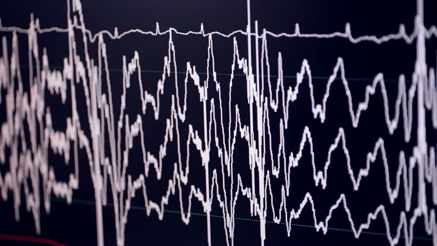 Real Cardiogram. Working Cardiograph In A Cardiology Hospital. Stock ...