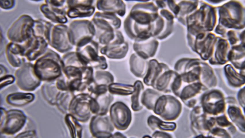 Seeing Sperm Activity Using A Microscope At Extreme Magnification ... Seeing Sperm Activity Using A Microscope At Extreme Magnification ...