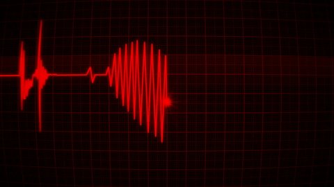 Abstract Cg Animation Heart Cardio Monitor Stock Footage Video (100%  Royalty-free) 28201081 | Shutterstock