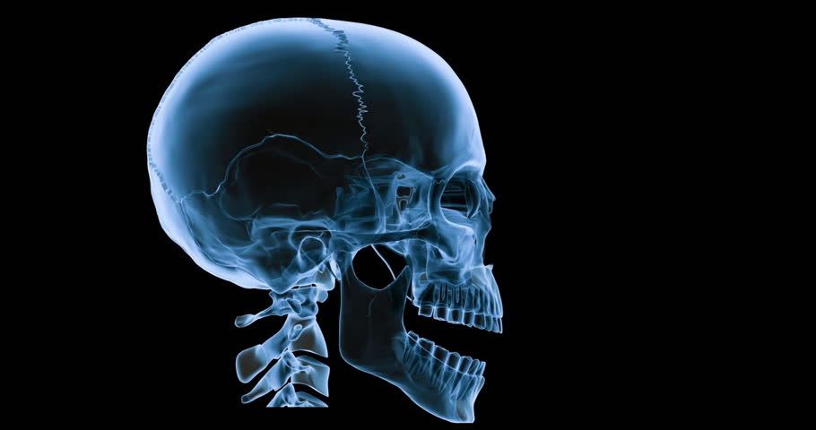 An Animated X-ray of a Stock Footage Video (100% Royalty-free) 29512561