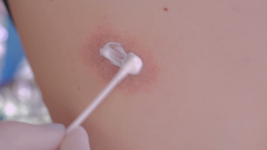 Header of balm